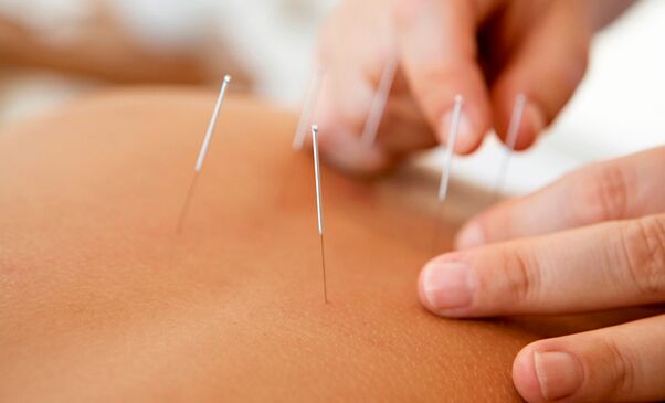 Akupunktur zur Potenzsteigerung